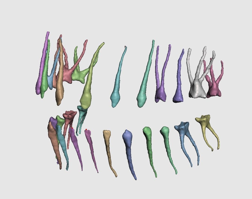 D009 Teeth anatomy 2 piece and solid pulp data for editing  3D print model_2