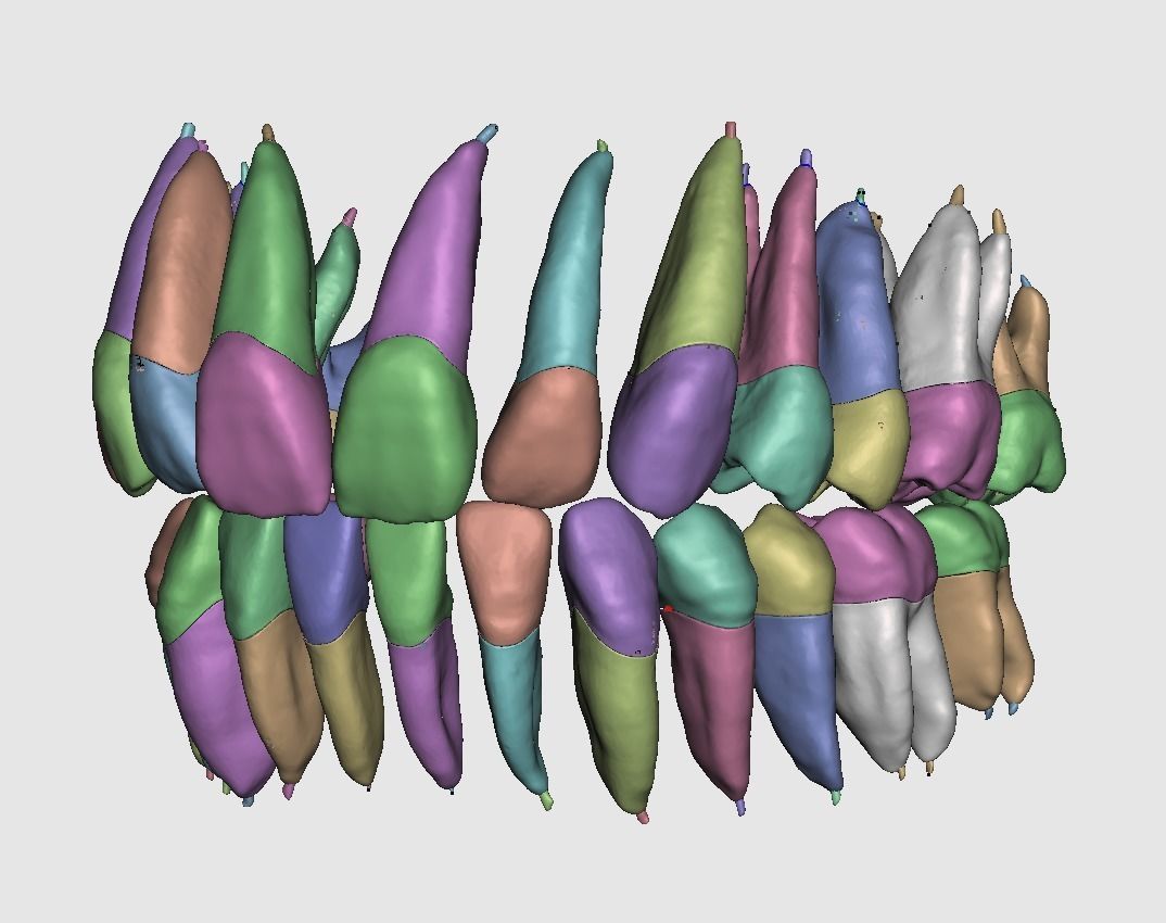D009 Teeth anatomy 2 piece and solid pulp data for editing  3D print model_1