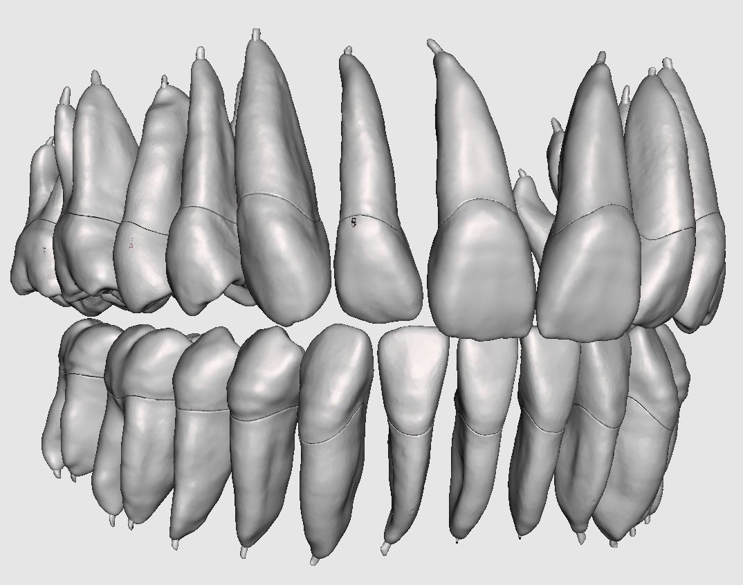 D009 Teeth anatomy 2 piece and solid pulp data for editing  3D print model_4