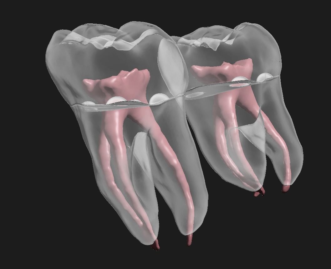 D009 Teeth anatomy 2 piece and solid pulp data for editing  3D print model_8