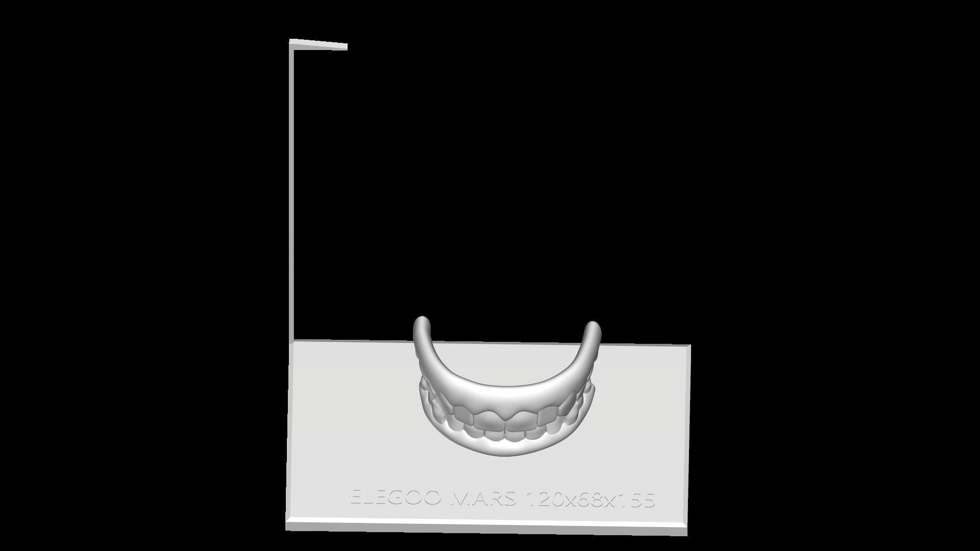 Teeth Dentures 3D file 3D print model_15