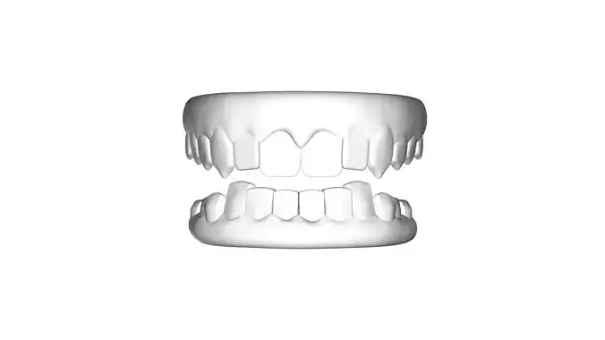 Teeth Dentures 3D file 3D print model