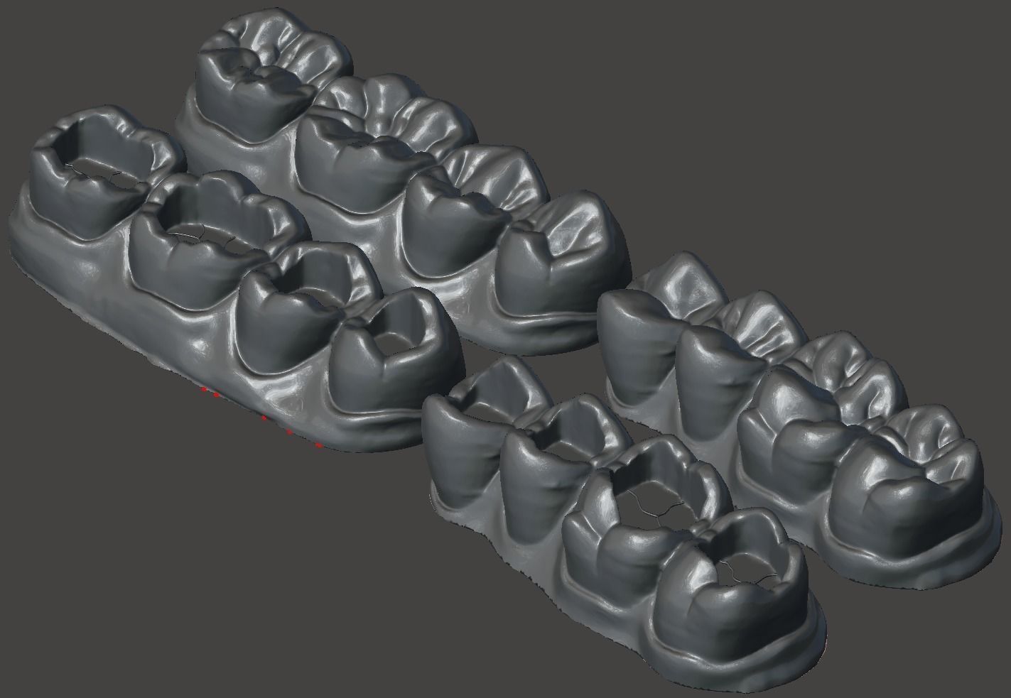 Dental Upper and Lower Arch Class 1 Models 3D print model_6