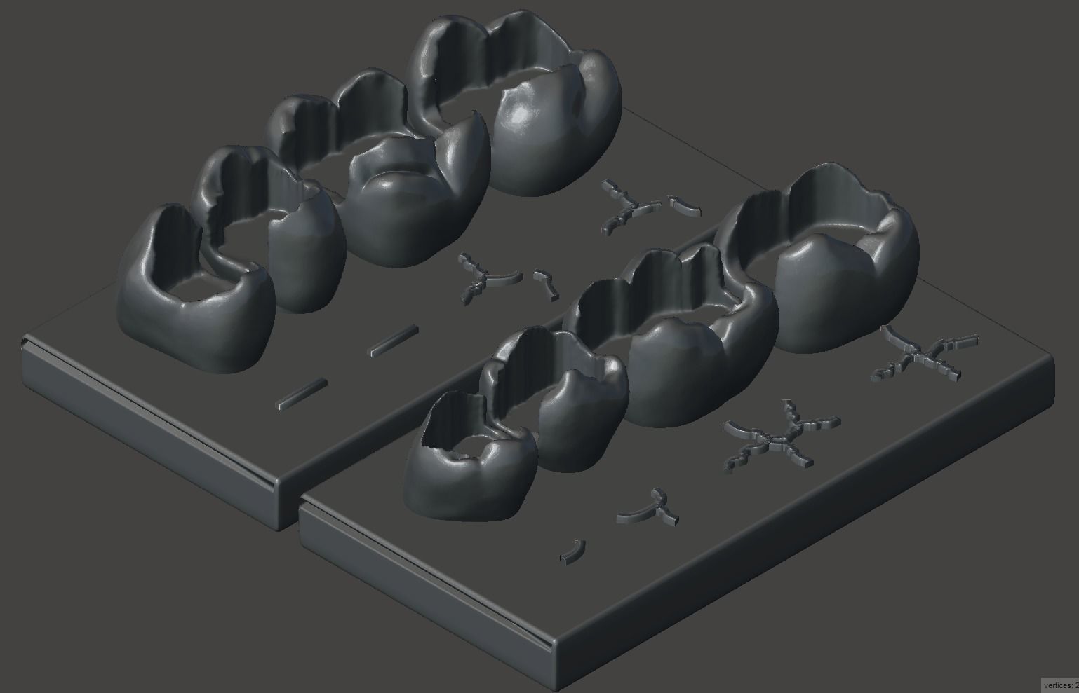 Dental Upper and Lower Arch Class 2 Models 3D print model_3