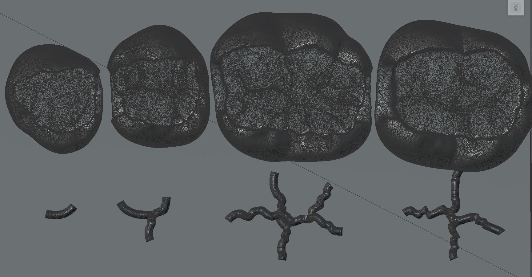 Dental Upper and Lower Arch Class 2 Models 3D print model_5