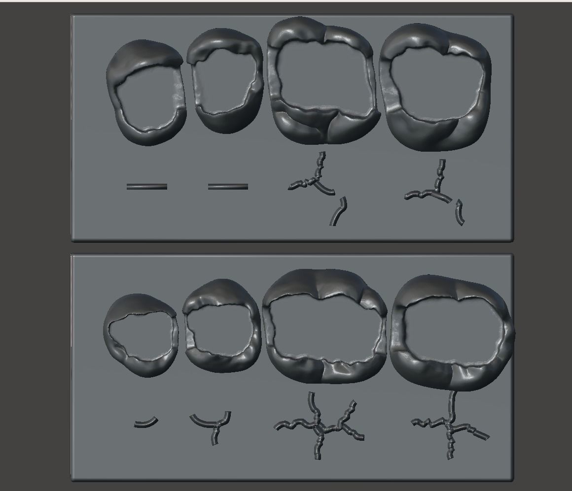 Dental Upper and Lower Arch Class 2 Models 3D print model_2