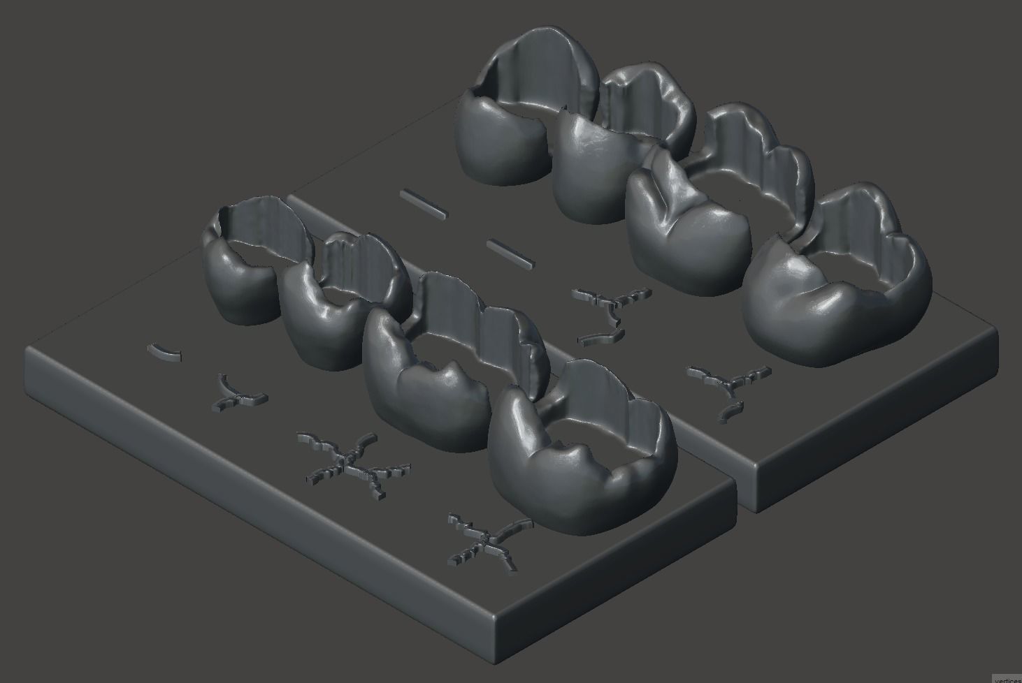 Dental Upper and Lower Arch Class 2 Models 3D print model_4