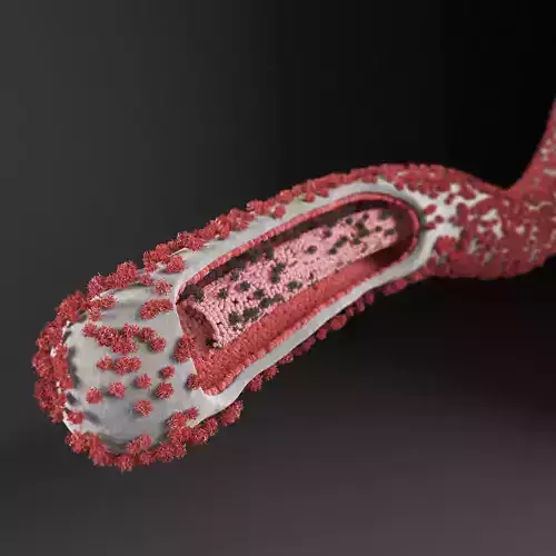Ebola Virus