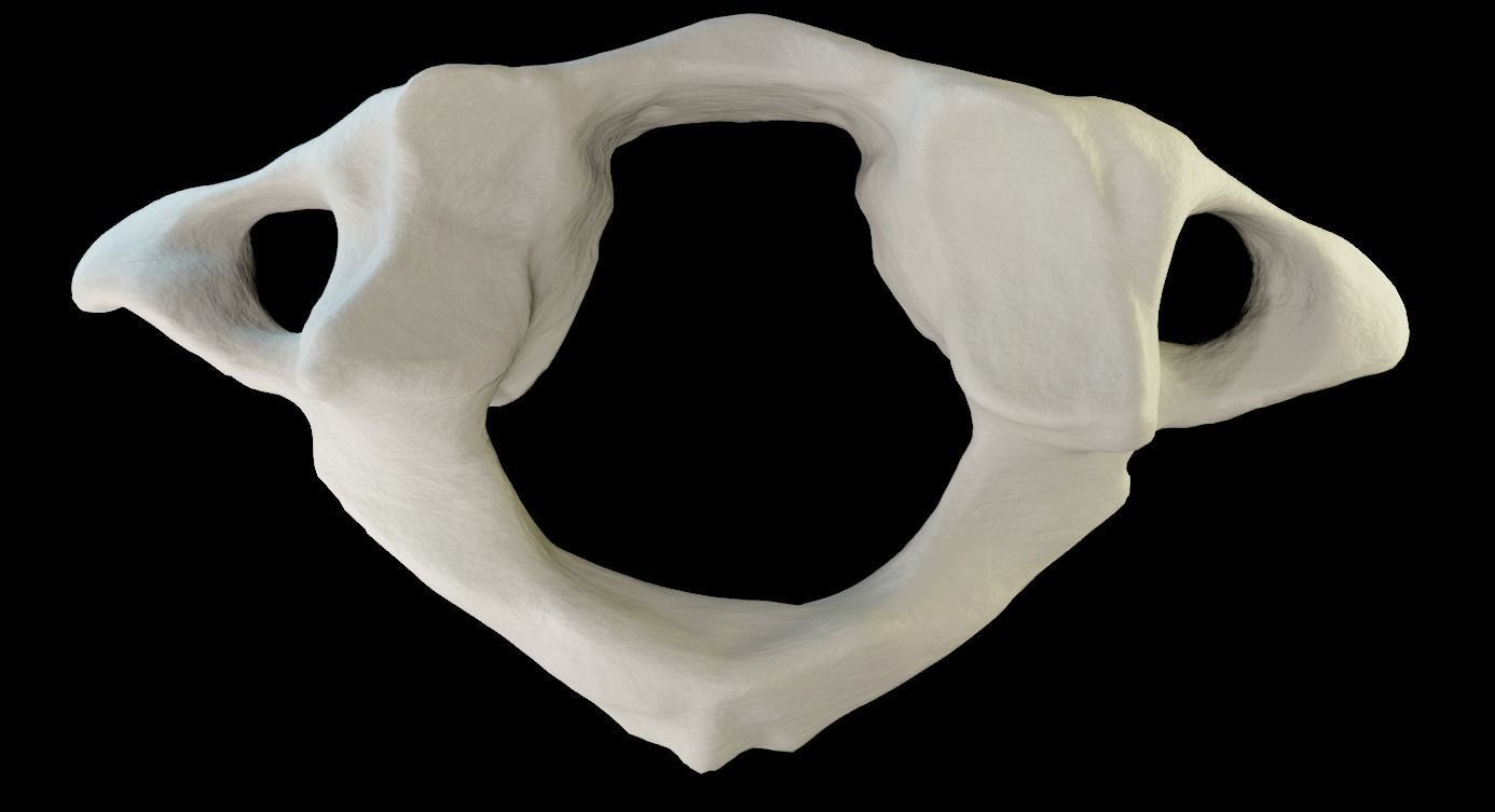 Atlas 1st cervical vertebra 3D model Low-poly 3D model_13