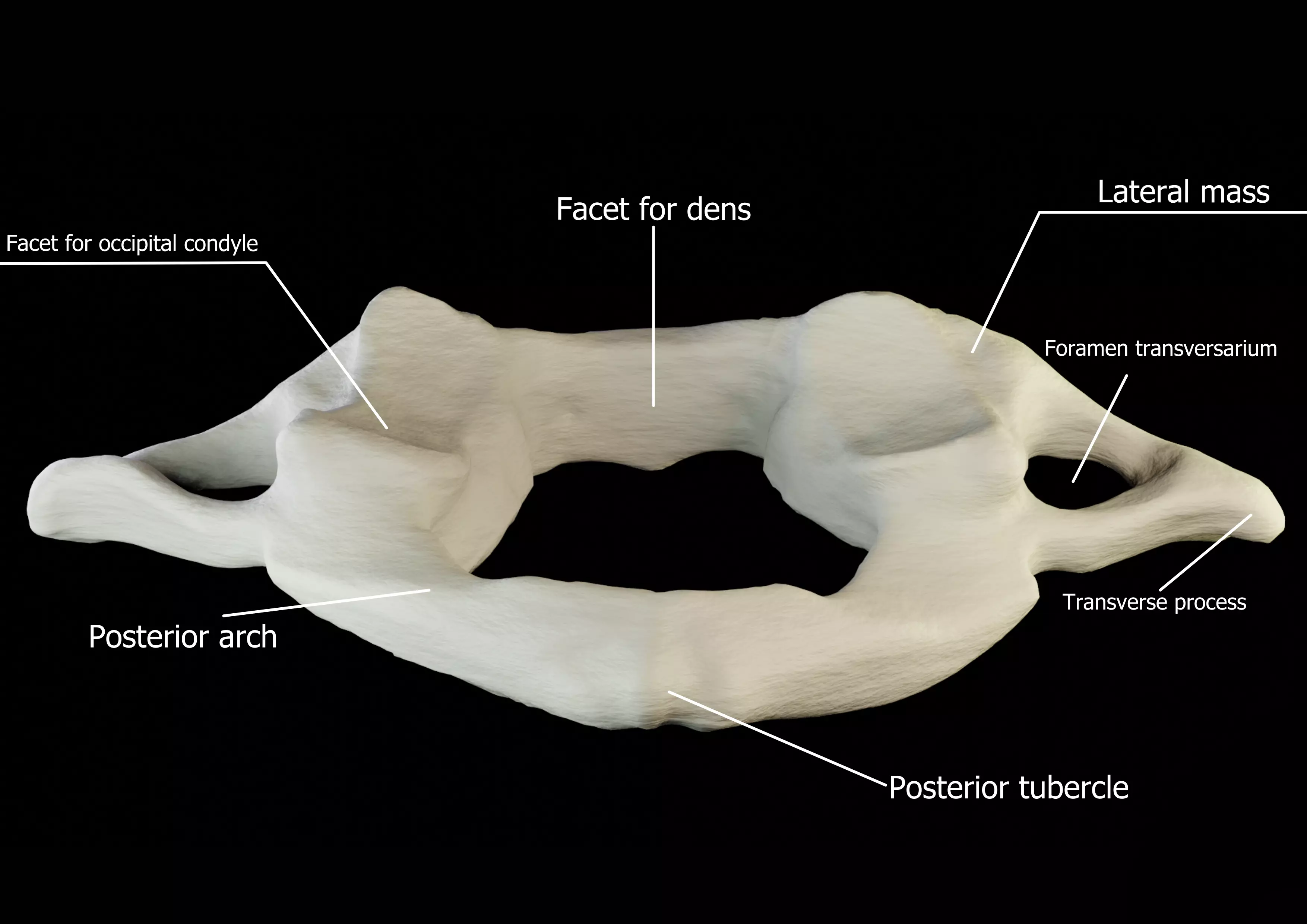 Atlas 1st cervical vertebra 3D model Low-poly 3D model_0