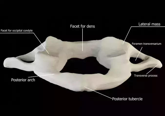 Atlas 1st cervical vertebra 3D model Low-poly 3D model