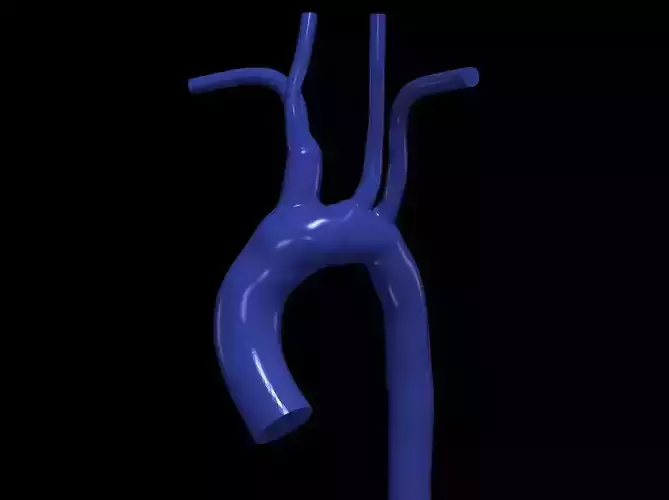 3d model of aorta