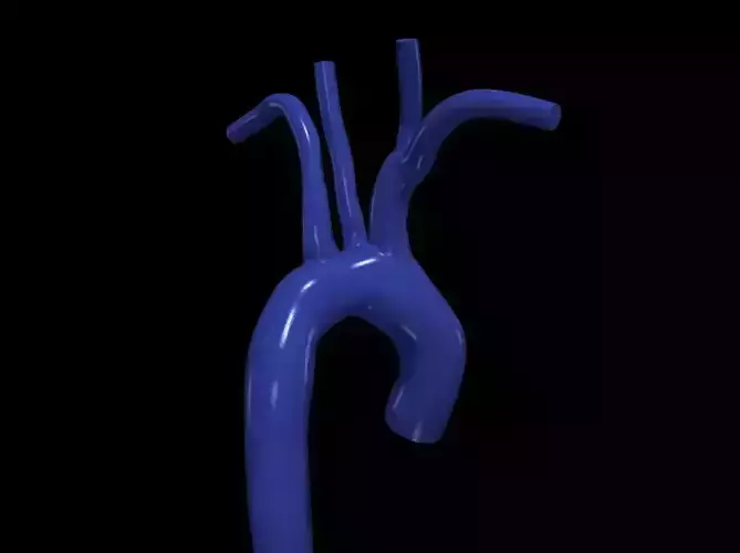 3d model of aorta