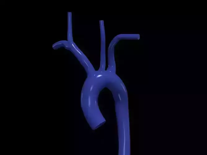 3d model of aorta