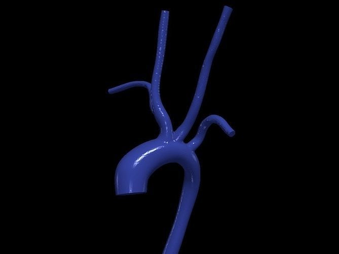 3d model of aorta 3D print model