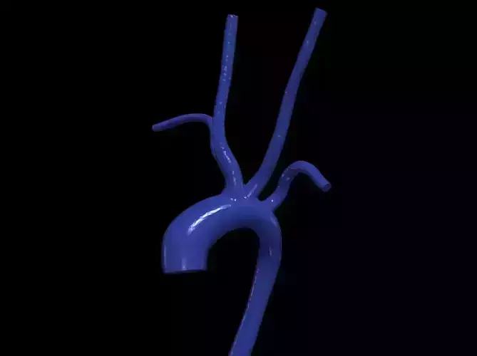 3d model of aorta