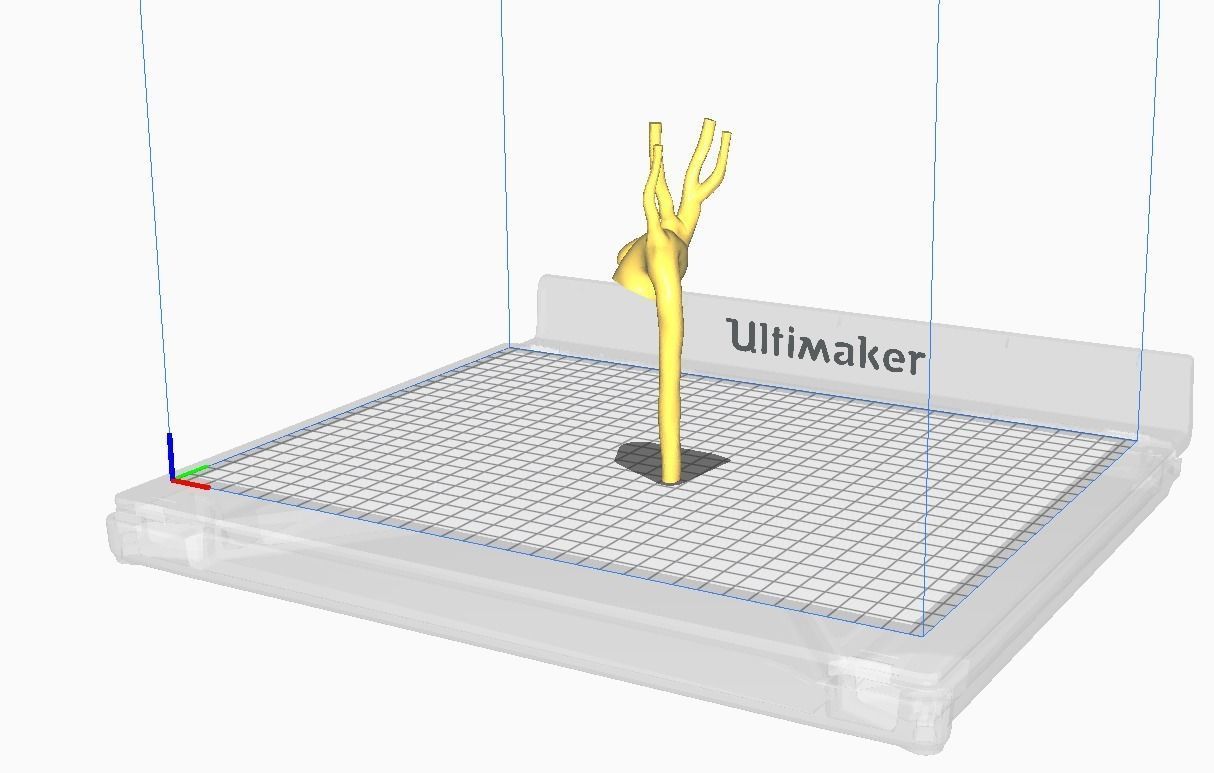 3d model of aorta 3D print model_4