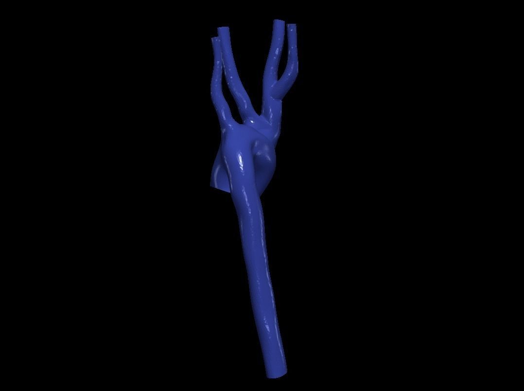 3d model of aorta 3D print model_3