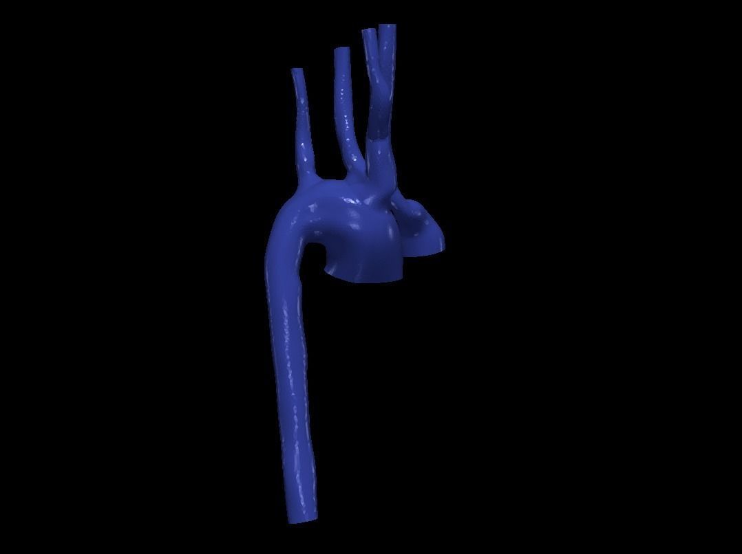 3d model of aorta 3D print model_2