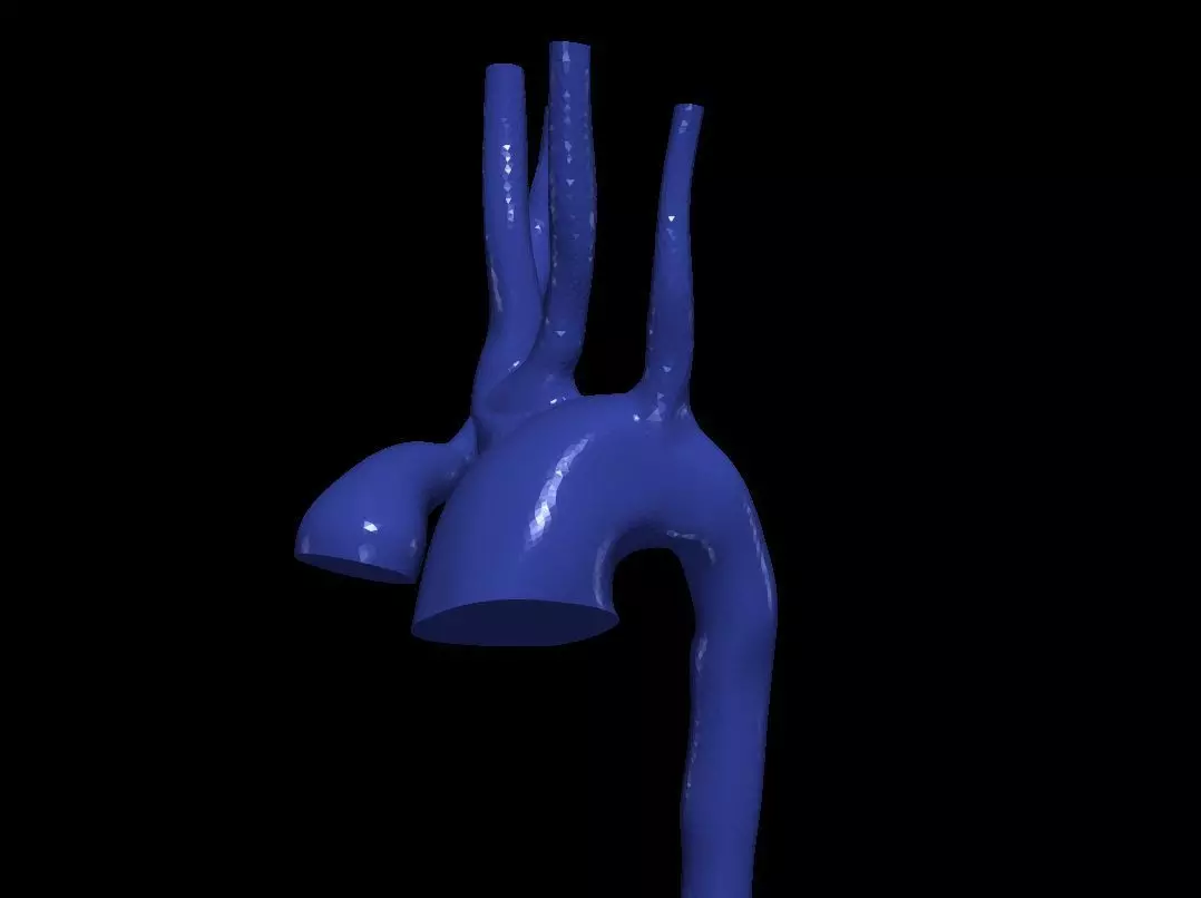 3d model of aorta 3D print model_0