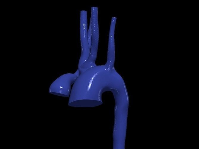 3d model of aorta 3D print model