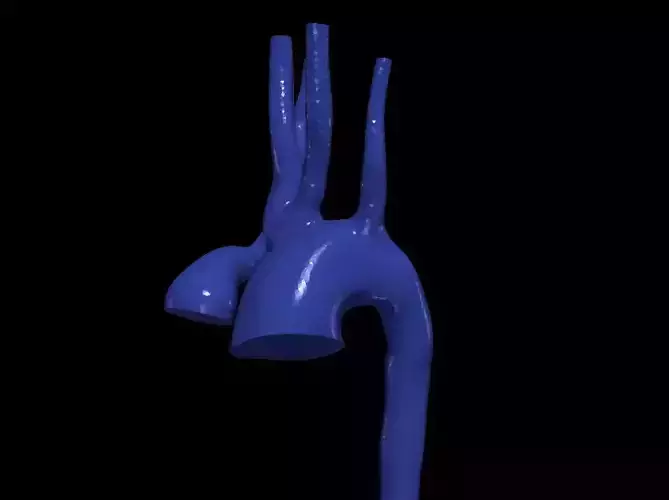 3d model of aorta