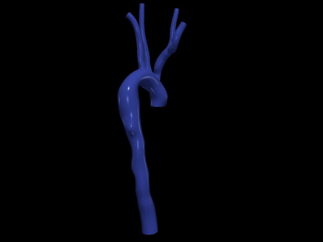 3d model of aorta 3D print model_6