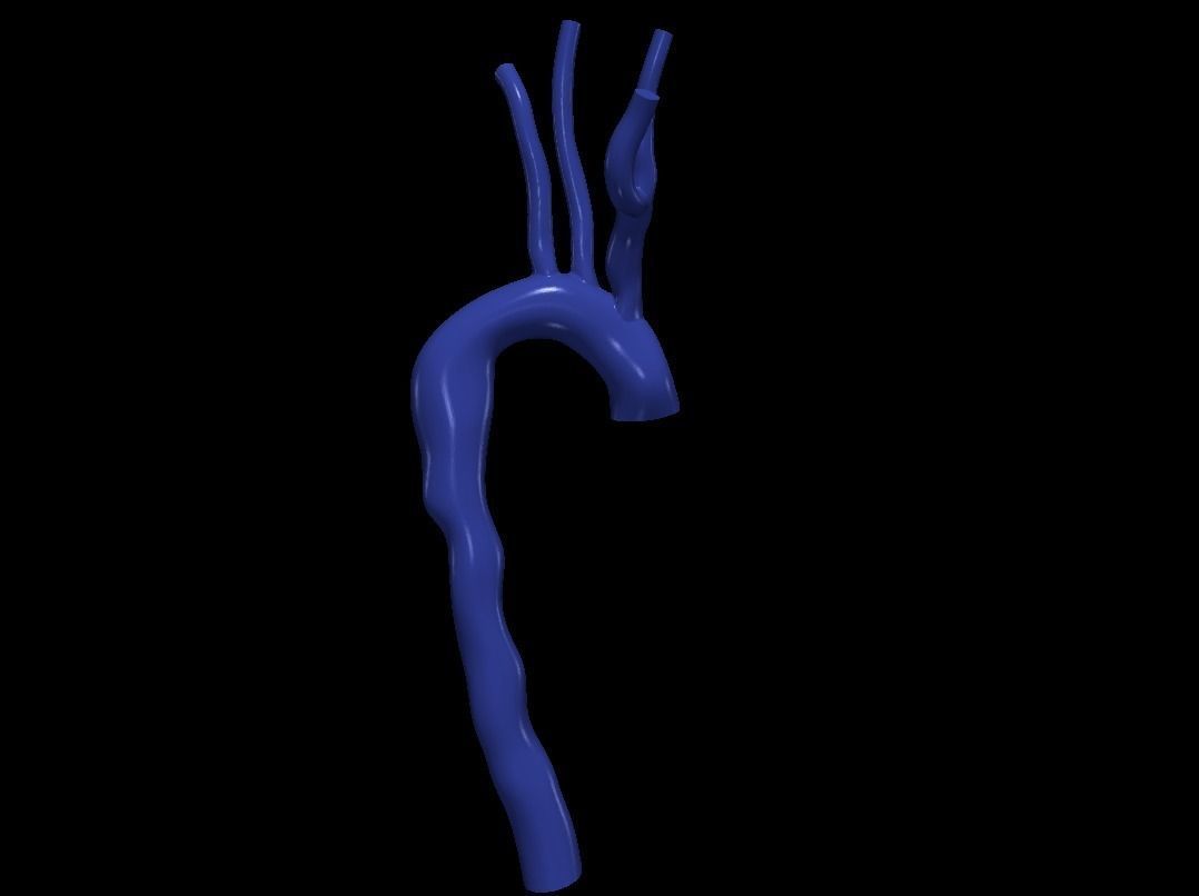 3d model of aorta 3D print model_4