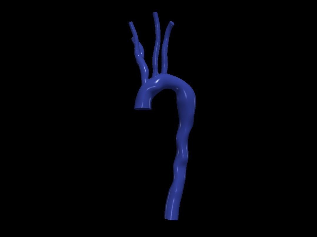 3d model of aorta 3D print model_1