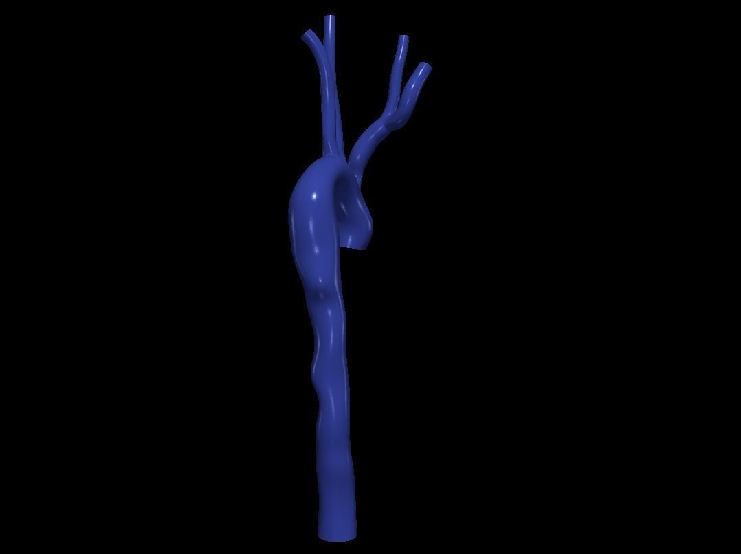 3d model of aorta 3D print model_7