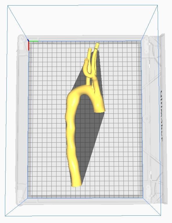 3d model of aorta 3D print model_9