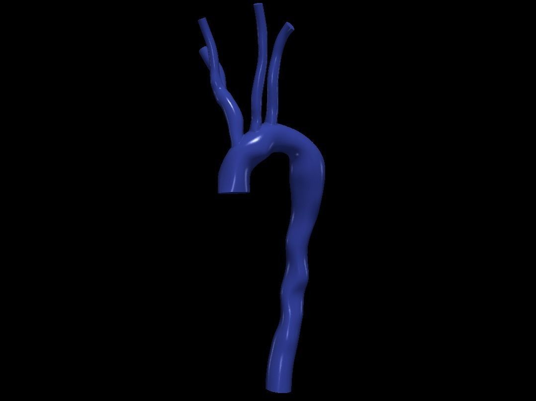 3d model of aorta 3D print model_5