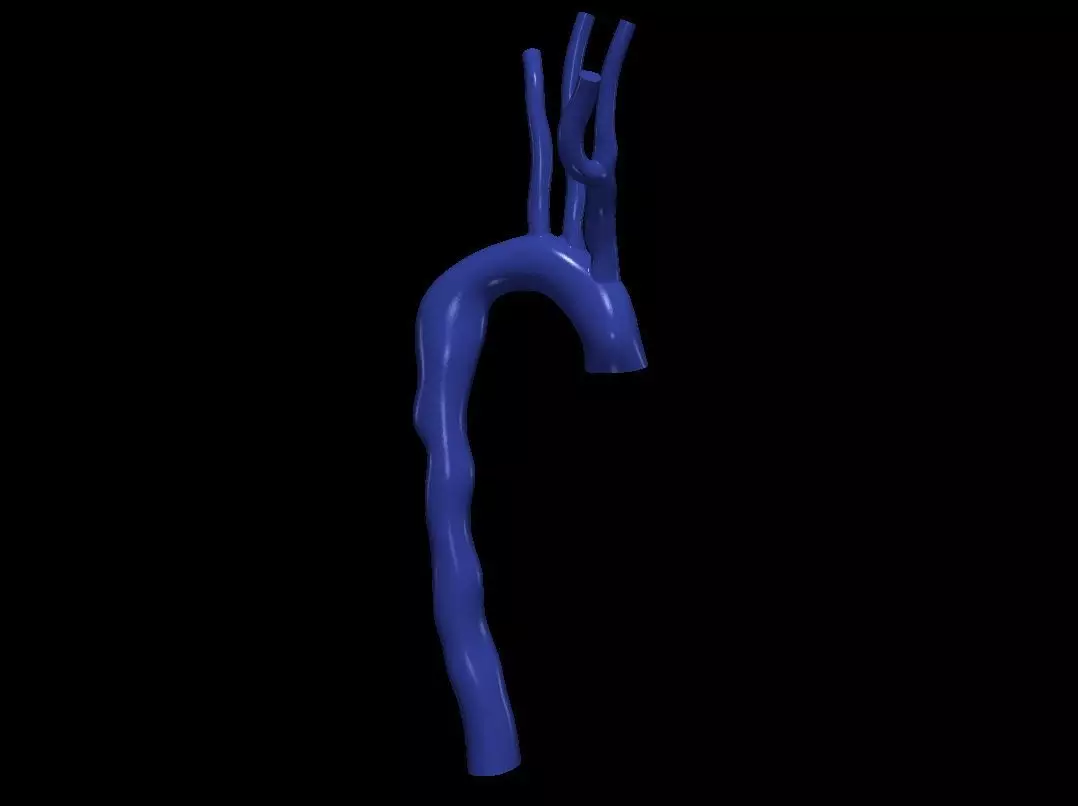 3d model of aorta 3D print model_0