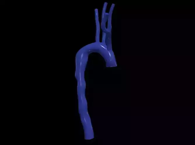 3d model of aorta