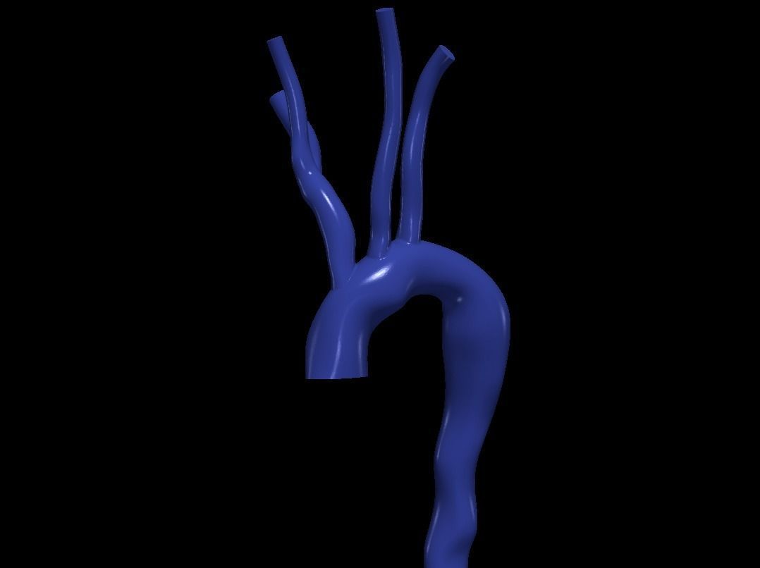 3d model of aorta 3D print model_3