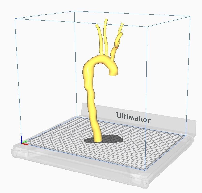 3d model of aorta 3D print model_8