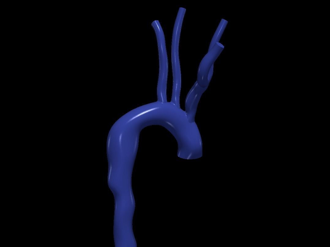 3d model of aorta 3D print model_2