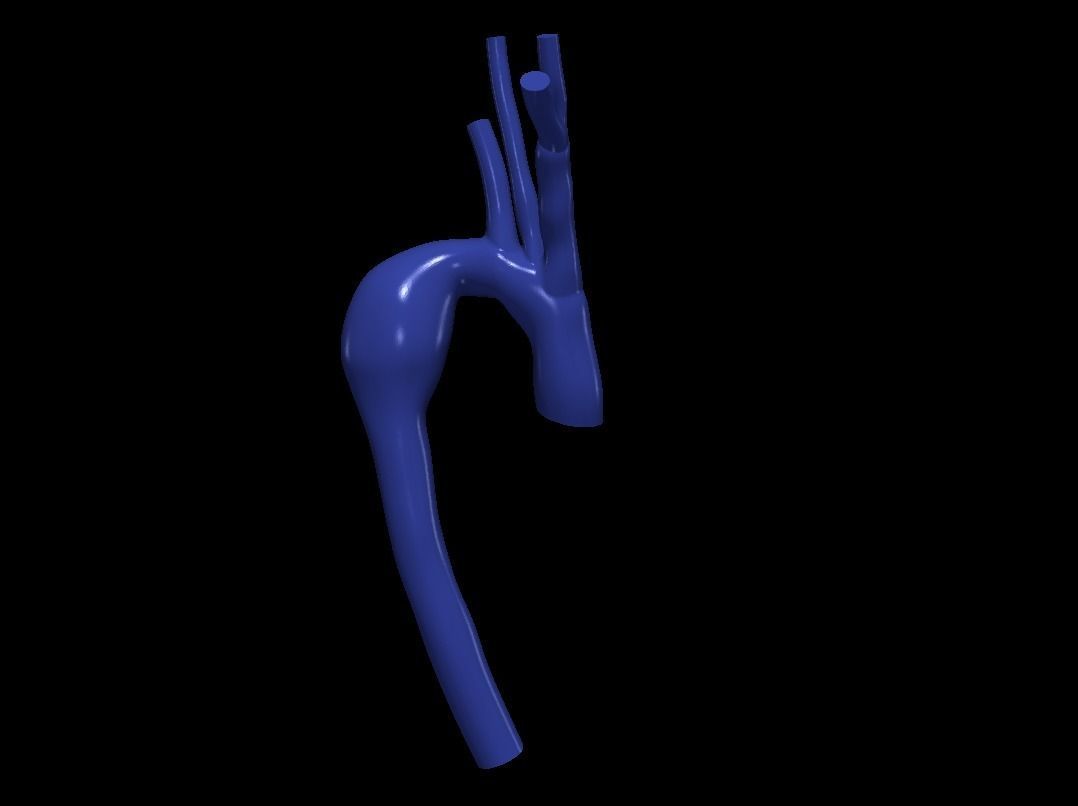 3d model of aorta 3D print model_4