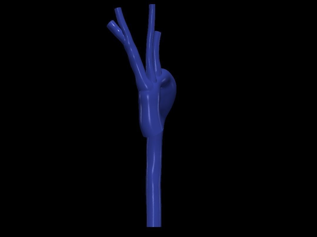 3d model of aorta 3D print model_6