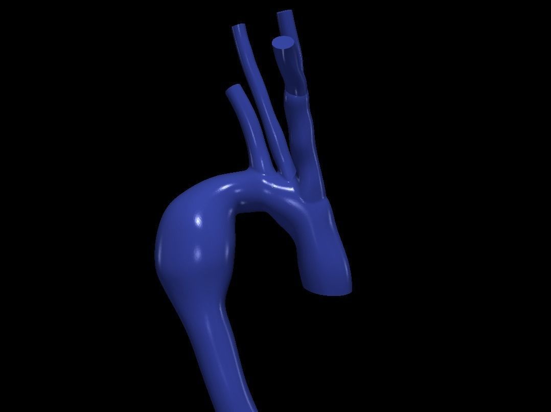 3d model of aorta 3D print model_2