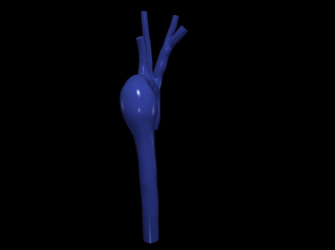 3d model of aorta 3D print model_5