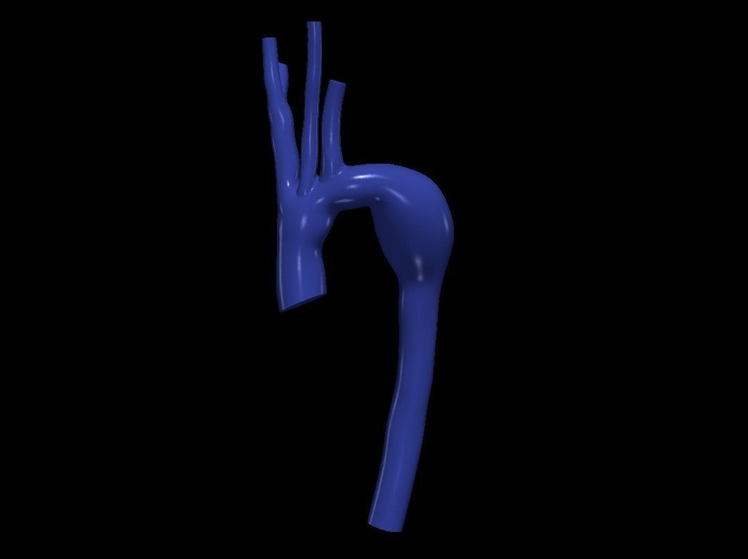 3d model of aorta 3D print model_3