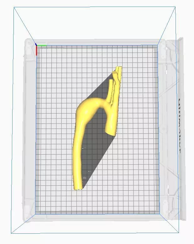 3d model of aorta 3D print model_0