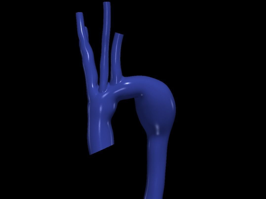 3d model of aorta 3D print model_1