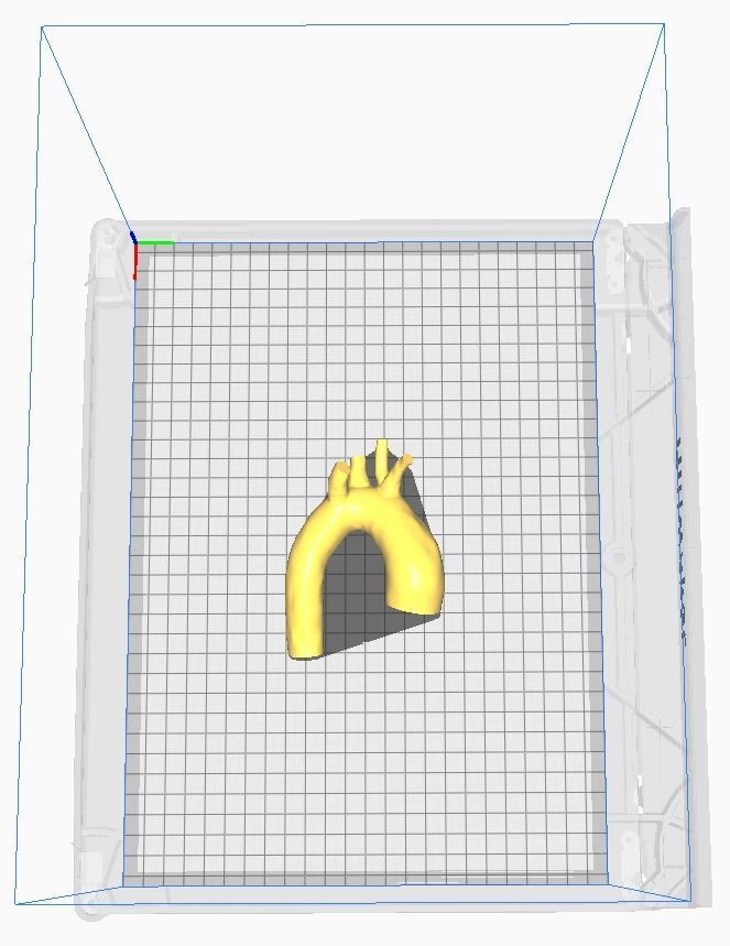 3d model of aorta 3D print model_2