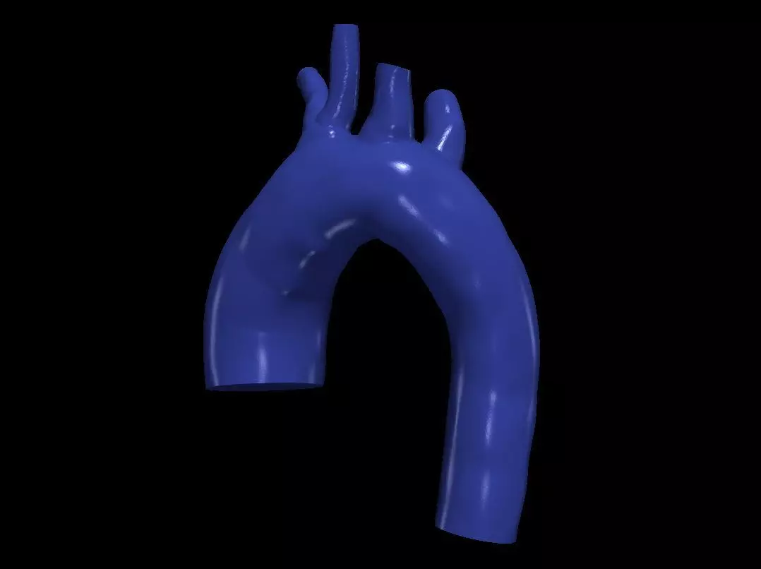 3d model of aorta 3D print model_0
