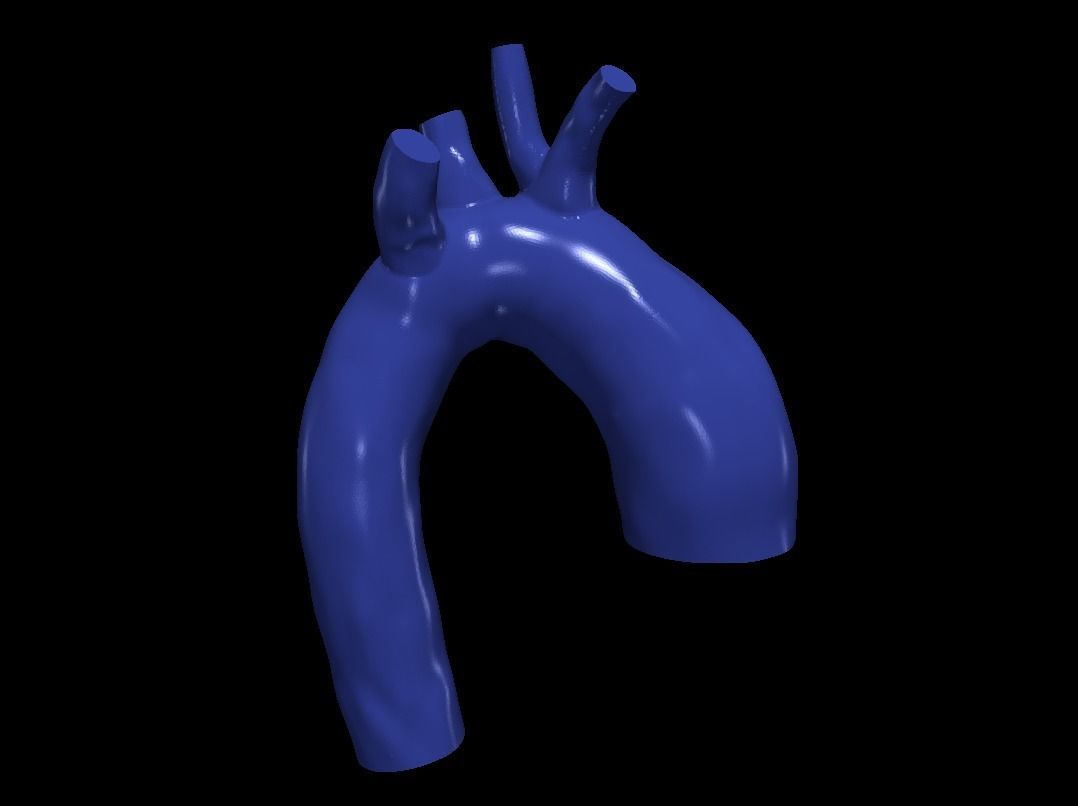 3d model of aorta 3D print model_1