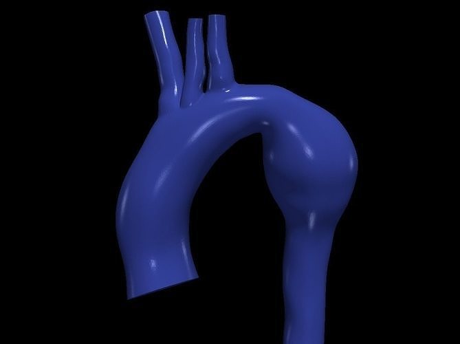 3d model of aorta 3D print model