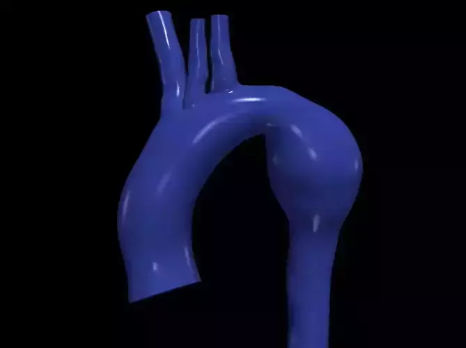 3d model of aorta