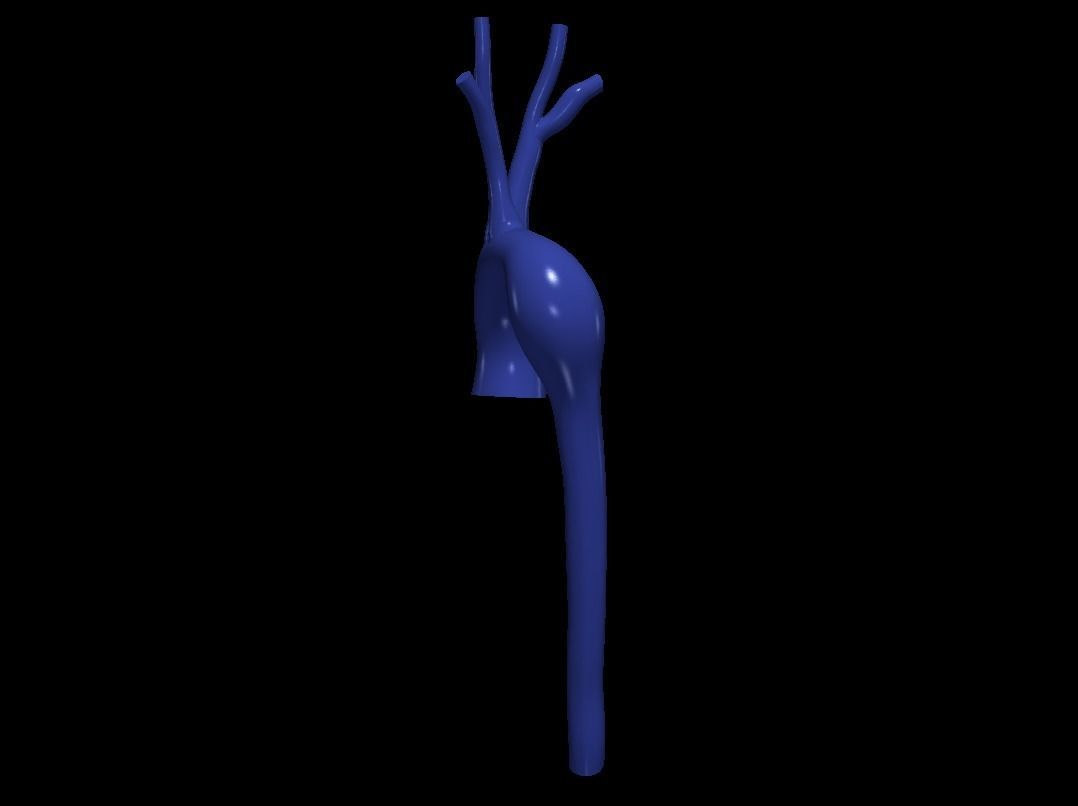 3d model of aorta 3D print model_7